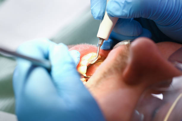Best Orthodontic Emergency Dentist in Lavaca, AR