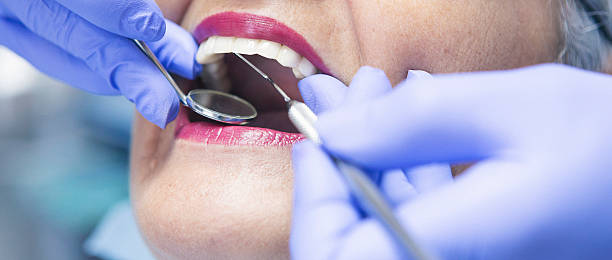 Best Emergency Root Canal Treatment in Lavaca, AR